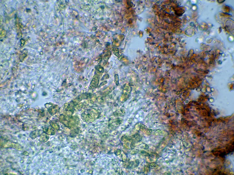 Basidiodendron caesiocinereum 10 - Cistidio-002